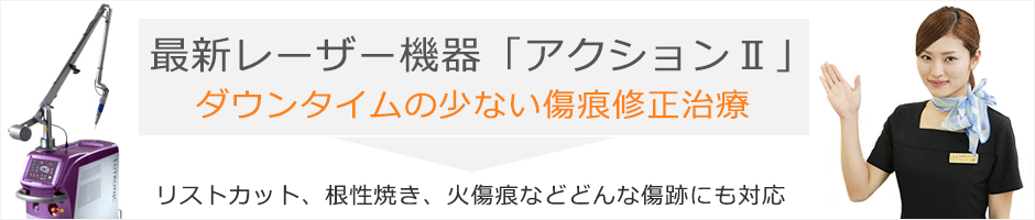 最新レーザー機器Action2はダウンタイムが少ない傷痕修正治療です。リストカット、根性焼き、火傷痕などどんな傷跡にも対応可能。