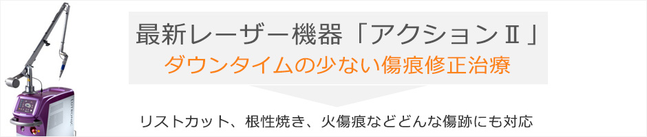 最新レーザー機器Action2はダウンタイムが少ない傷痕修正治療です。リストカット、根性焼き、火傷痕などどんな傷跡にも対応可能。