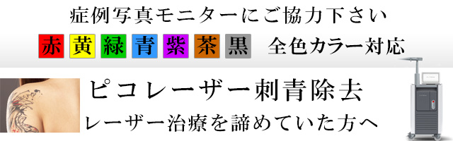 刺青・タトゥー除去治療のモニター募集